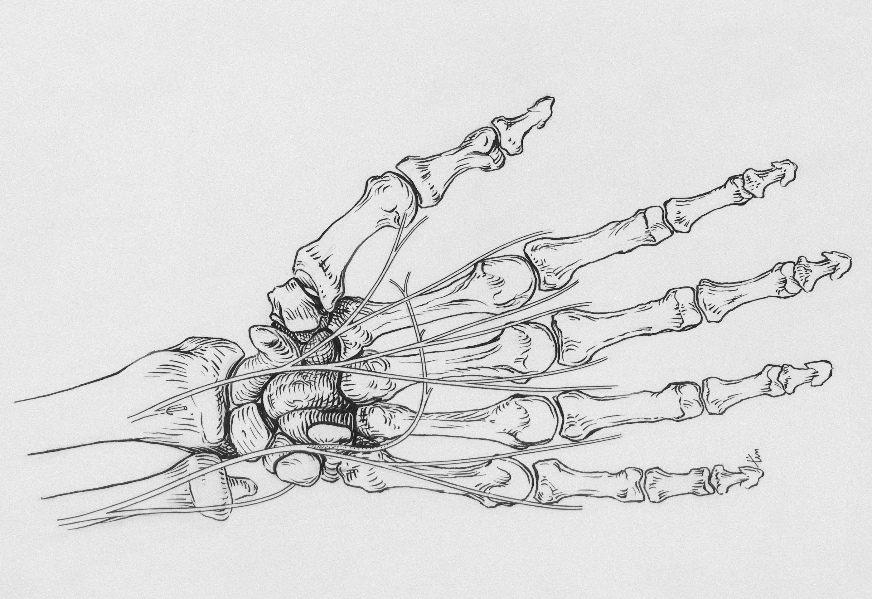 articles/handknochen_anatomische_zeichnung.jpg